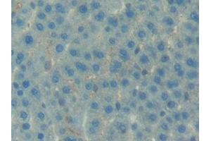 Immunohistochemistry (IHC) image for anti-Insulin-Like Growth Factor Binding Protein 7 (IGFBP7) (AA 88-281) antibody (ABIN7439126)