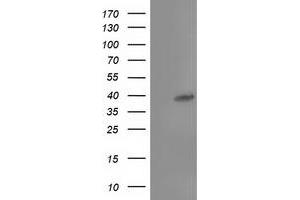 Western Blotting (WB) image for anti-TBC1 Domain Family, Member 21 (TBC1D21) antibody (ABIN1501313) (TBC1D21 Antikörper)