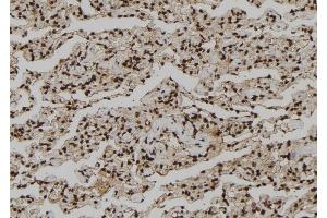 ABIN6260913 and ABIN6273210 at 1/100 staining Human lung tissue by IHC-P. (CNOT10 Antikörper  (Internal Region))