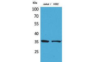 Western Blotting (WB) image for anti-Apurinic/Apyrimidinic Endonuclease 1 (APEX1) (Ser1423) antibody (ABIN3187837) (APEX1 Antikörper  (Ser1423))