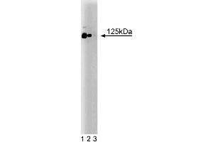 Western blot analysis of CD51 (Integrin alphaV) on a rat cerebrum lysate.