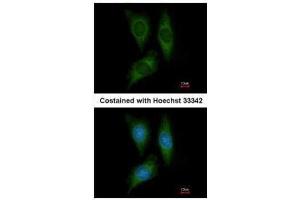 ICC/IF Image Immunofluorescence analysis of methanol-fixed HeLa, using STK25, antibody at 1:200 dilution. (STK25 Antikörper)