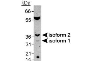 Western blot analysis of SPDYA in mouse testis with SPDYA polyclonal antibody . (SPDYA Antikörper  (AA 200-286))