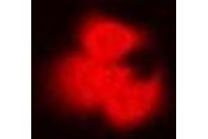 Immunofluorescent analysis of PP2C-alpha staining in Hela cells. (PPM1A Antikörper)