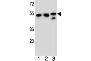 TUBB6 antibody western blot analysis in K562, HeLa, MDA-MB231 lysate. (TUBb6 Antikörper  (AA 139-166))