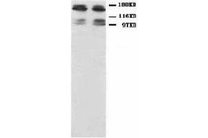 Image no. 1 for anti-Glutamate Receptor, Ionotropic, N-Methyl D-Aspartate 2B (GRIN2B) (N-Term) antibody (ABIN1494122) (GRIN2B Antikörper  (N-Term))