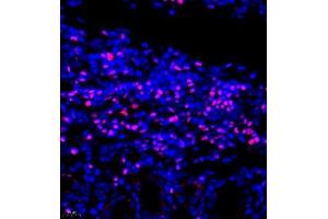 Immunofluorescence of paraffin embedded rat kidney using TCF7 (ABIN7075952) at dilution of 1:600 (400x lens) (TCF7 Antikörper)