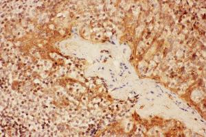 Anti- IL2RA antibody, IHC(P) IHC(P): Human Tonsil Tissue (CD25 Antikörper  (N-Term))