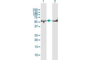 Western Blot analysis of TBL2 expression in transfected 293T cell line by TBL2 MaxPab polyclonal antibody. (TBL2 Antikörper  (AA 1-447))