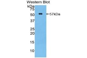 Western blot analysis of the recombinant protein. (GZMM Antikörper  (AA 31-257))