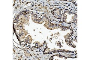 IHC analysis of MMP2 using anti-MMP2 antibody (ABIN7601677). (MMP2 Antikörper  (AA 411-660))