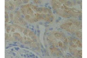 IHC-P analysis of Human Kidney Tissue, with DAB staining. (BMX Antikörper  (AA 287-523))