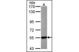 Sample (30 µg of whole cell lysate). (CYP26B1 Antikörper)