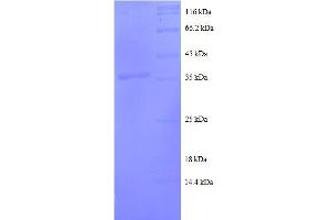 Chemokine (C-C Motif) Ligand 20 (CCL20) (AA 27-95), (full length) protein (GST tag) (CCL20 Protein (AA 27-95, full length) (GST tag))