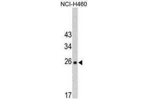 Image no. 1 for anti-FK506 Binding Protein 14, 22 KDa (FKBP14) (N-Term) antibody (ABIN453010) (FKBP14 Antikörper  (N-Term))