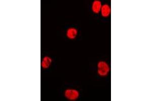 Immunofluorescent analysis of Lamin A/C staining in HeLa cells. (Lamin A/C Antikörper  (Center))