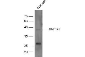Mouse stomach lysates probed with Anti-RNF149 Polyclonal Antibody  at 1:5000 90min in 37˚C (RNF149 Antikörper)
