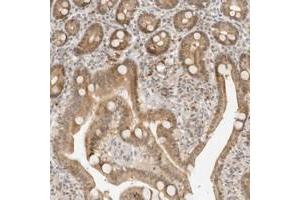 Immunohistochemical staining of human duodenum with NEO1 polyclonal antibody  shows moderate nuclear and cytoplasmic positivity in glandular cells at 1:10-1:20 dilution. (NEO1 Antikörper)