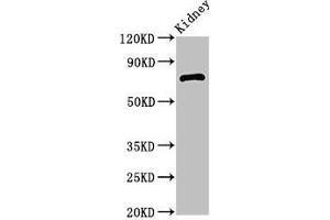Western Blot Positive WB detected in: Mouse kidney tissue All lanes: ZBTB16 antibody at 2. (ZBTB16 Antikörper  (AA 126-420))