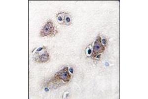 Image no. 2 for anti-Cytochrome P450, Family 26, Subfamily C, Polypeptide 1 (CYP26C1) (C-Term) antibody (ABIN360260) (CYP26C1 Antikörper  (C-Term))