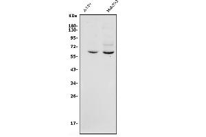 Western blot analysis of GRB14 using anti-GRB14 antibody (ABIN7599149).