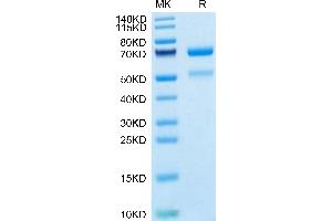 Human CTGF on Tris-Bis PAGE under reduced condition. (CTGF Protein (AA 27-349) (Fc Tag))