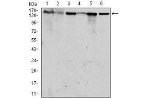 Western blot analysis using MSH6 mouse mAb against HEK293 (1), HCT116 (2), A549 (3), A431 (4), MCF-7 (5) and HepG2 (6) cell lysate. (MSH6 Antikörper)