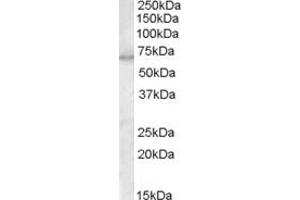 Image no. 5 for anti-Myotubularin 1 (MTM1) (C-Term) antibody (ABIN184636)