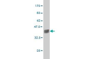 Western Blot detection against Immunogen (37. (ZNF41 Antikörper  (AA 221-321))