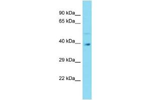 Western Blotting (WB) image for anti-G Protein Pathway Suppressor 2 (GPS2) (N-Term) antibody (ABIN2789898)