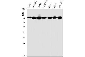 Western blot analysis of HGS using anti-HGS antibody (ABIN7601205). (HGS Antikörper  (AA 3-777))