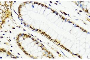 Immunohistochemistry of paraffin-embedded Human colon using CTCF Polyclonal Antibody at dilution of 1:100 (40x lens). (CTCF Antikörper)