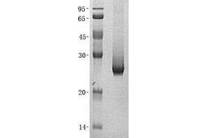 Western Blotting (WB) image for Dicarbonyl/L-Xylulose Reductase (DCXR) (Transcript Variant 2) protein (His tag) (ABIN2724445)