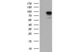Western Blotting (WB) image for anti-phosphoinositide-3-Kinase Adaptor Protein 1 (PIK3AP1) antibody (ABIN1496824) (PIK3AP1 Antikörper)