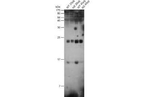 Figure: 20 or 40 ug of total protein from Arabidopsis thaliana (WT) Leafs or ferredoxin mutant fd2 were separated on 15 % acrylamide gel with 6 M urea. (Ferredoxin1 (FDX1) Antikörper)