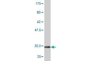 Western Blotting (WB) image for anti-Solute Carrier Family 2 (Facilitated Glucose Transporter), Member 4 (SLC2A4) (AA 467-509) antibody (ABIN520232)