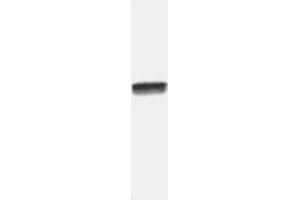 Image no. 2 for anti-Nuclear Factor-kB p65 (NFkBP65) (C-Term) antibody (ABIN221155) (NF-kB p65 Antikörper  (C-Term))