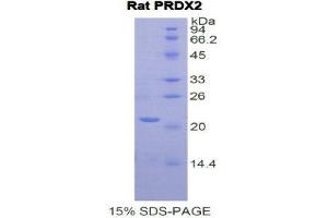 SDS-PAGE (SDS) image for Peroxiredoxin 2 (PRDX2) (AA 6-164) protein (His tag) (ABIN1877331) (Peroxiredoxin 2 Protein (PRDX2) (AA 6-164) (His tag))