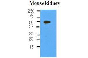 The extracts of mouse kidney (50 ug) were resolved by SDS-PAGE, transferred to nitrocellulose membrane and probed with anti-human PDPN (1:500). (Podoplanin Antikörper  (AA 1-206))