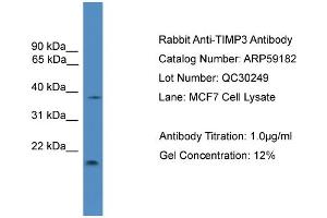 Western Blotting (WB) image for anti-TIMP Metallopeptidase Inhibitor 3 (TIMP3) (Middle Region) antibody (ABIN2787969)