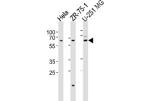 Western blot analysis of lysates from Hela, ZR-75-1, U-251 MG cell line (from left to right), using STS2 Antibody (C-term) (ABIN6244259 and ABIN6577456). (SPATS2 Antikörper  (C-Term))