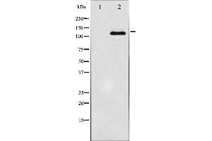 Western blot analysis of JAK2 expression in HT29 whole cell lysates,The lane on the left is treated with the antigen-specific peptide. (JAK2 Antikörper  (C-Term))