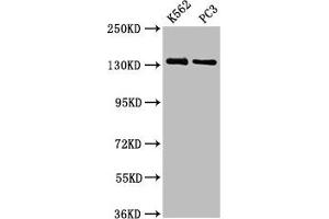 Western Blot Positive WB detected in: K562 whole cell lysate, PC-3 whole cell lysate All lanes: NRDC antibody at 3. (NRD1 Antikörper  (AA 32-113))