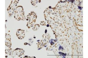 Immunostaining (ISt) image for anti-Runt-Related Transcription Factor 2 (RUNX2) (AA 251-350) antibody (ABIN514045)