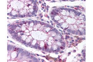 Anti-PLK1 antibody IHC of human colon. (PLK1 Antikörper  (pThr210))