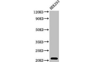 Western Blot Positive WB detected in: HEK293 whole cell lysate All lanes: TSR2 antibody at 2 μg/mL Secondary Goat polyclonal to rabbit IgG at 1/50000 dilution Predicted band size: 21 kDa Observed band size: 21 kDa (TSR2 Antikörper  (AA 1-191))