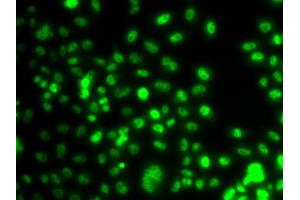 Immunofluorescence analysis of A549 cell using PAX6 antibody.