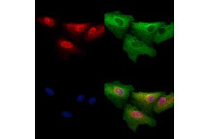 ABIN6257358 and ABIN6273564 staining  cells by IF/ICC.