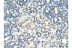 ZMYND11 antibody was used for immunohistochemistry at a concentration of 4-8 ug/ml to stain Epithelial cells of renal tubule (arrows) in Human Kidney. (ZMYND11 Antikörper  (N-Term))