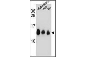 Western blot analysis of NDUFC2 Antibody (C-term) in MDA-MB453,Hela,293 cell line lysates (35ug/lane). (NDUFC2 Antikörper  (C-Term))